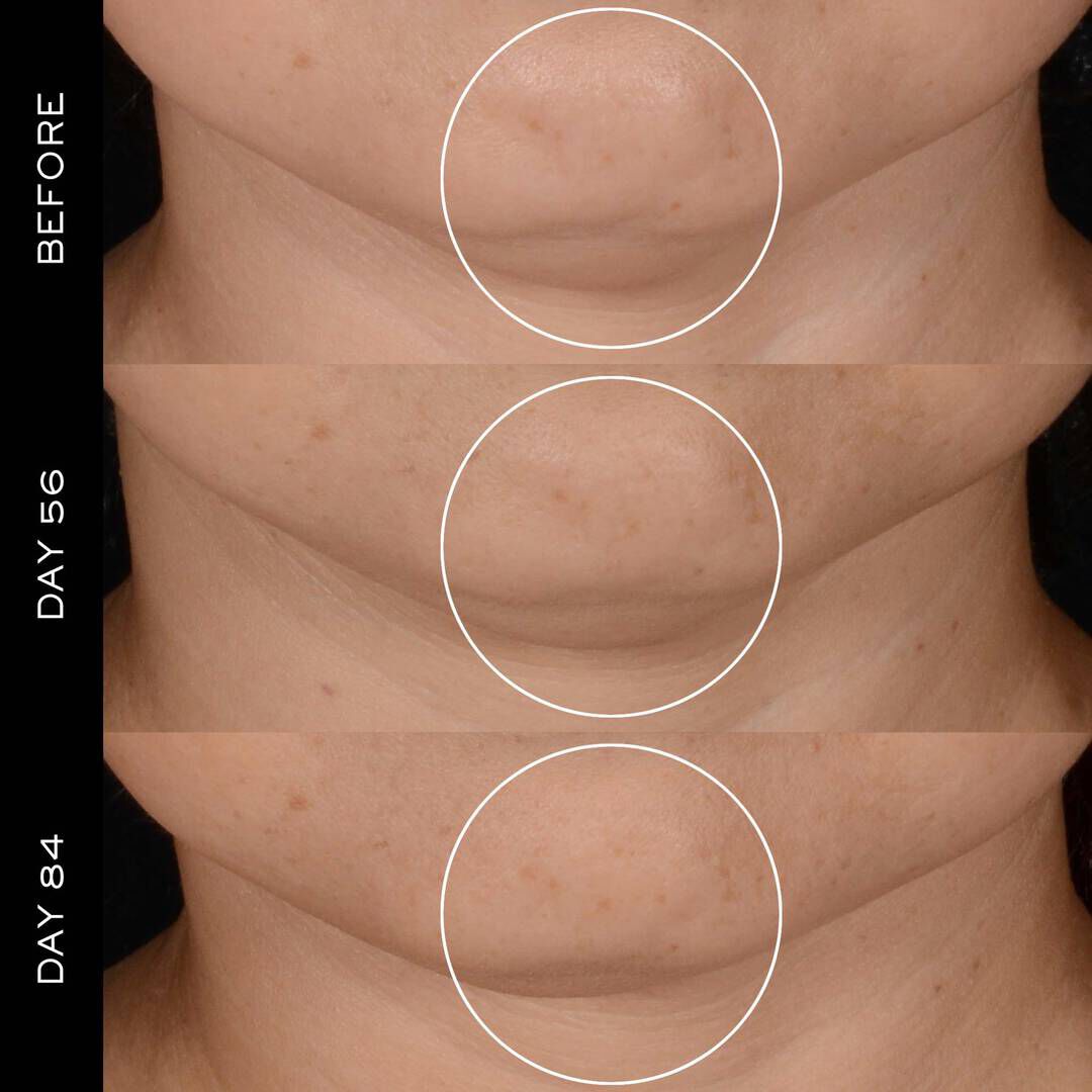 Renergie H.P.N. 300-Peptide Cream 50ml + Recharge