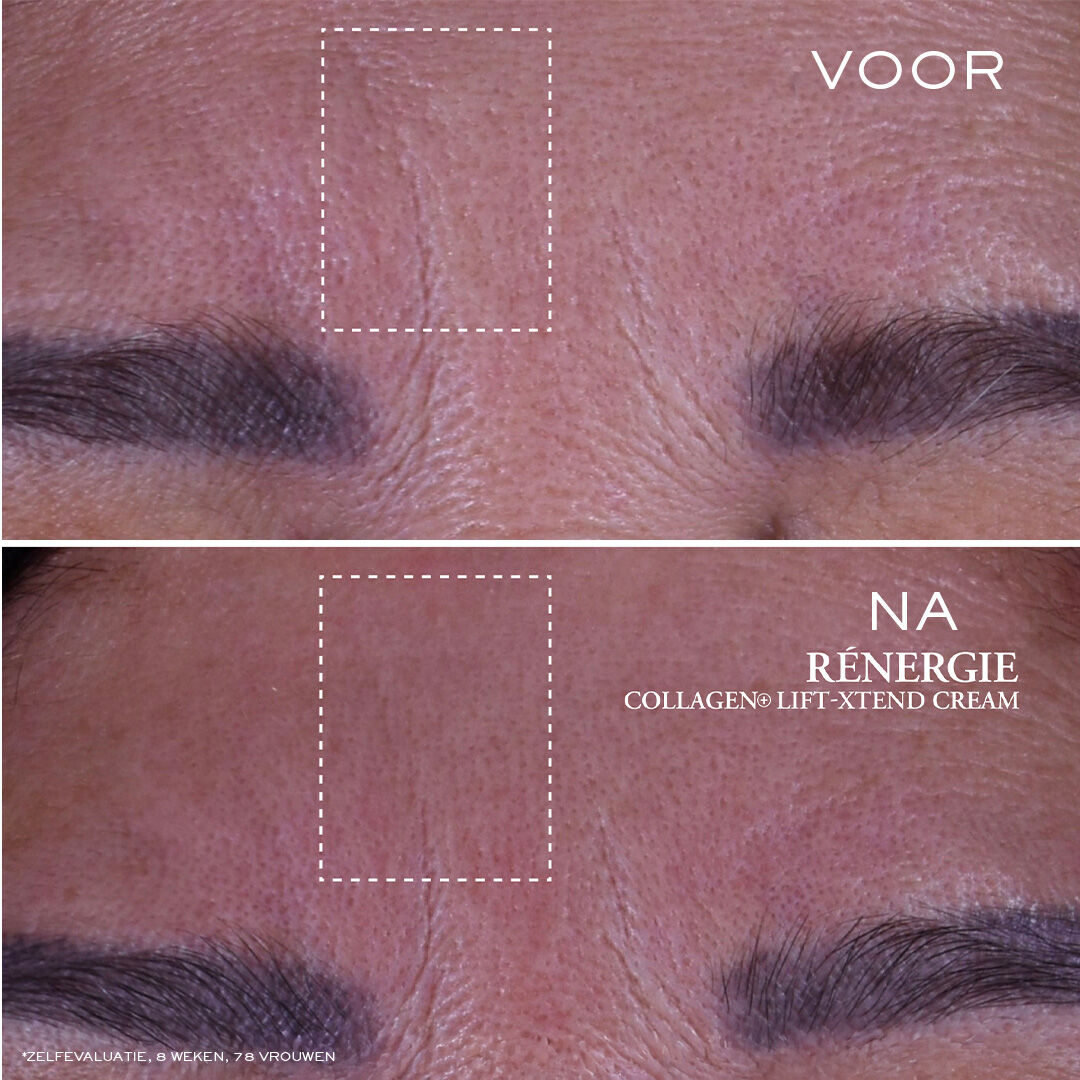 Renergie Collagen+ Lift-Xtend Cream